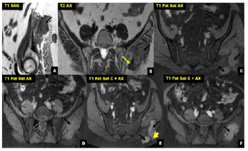 oncologyradiotherapy-Abdominal