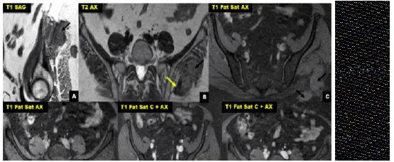 oncologyradiotherapy-MRI