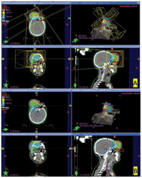 oncologyradiotherapy-dosimetry