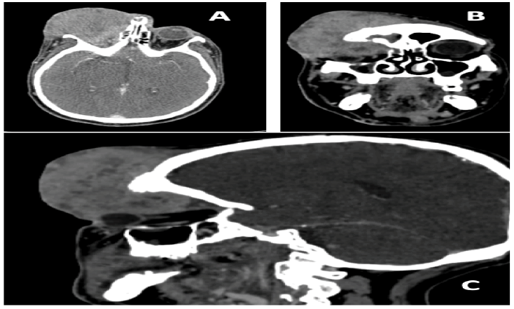 oncologyradiotherapy-sagittal