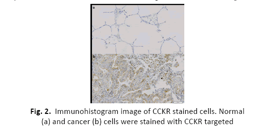 oncologyradiotherapy-stained