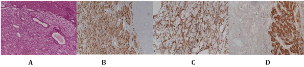 oncology-cells