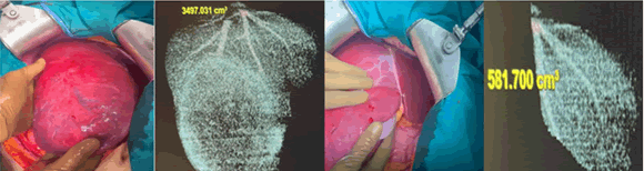 oncology-imaging