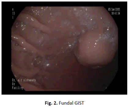 oncologyradiotherapy-Fundal oncologyradiotherapy-Fundal