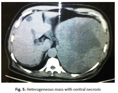 oncologyradiotherapy-Heterogeneous