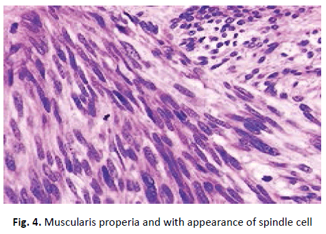 oncologyradiotherapy-Muscularis-properia