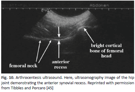 oncologyradiotherapy-arthrocentesis