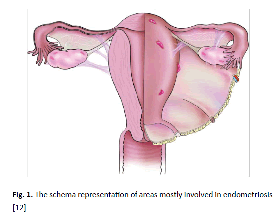 oncologyradiotherapy-gamma-fitted