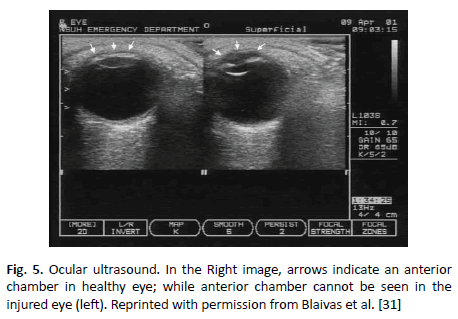 oncologyradiotherapy-ocular