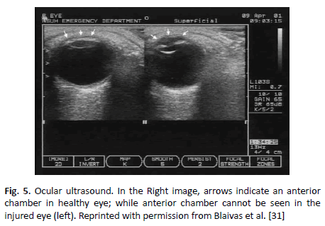 oncologyradiotherapy-ocular oncologyradiotherapy-ocular