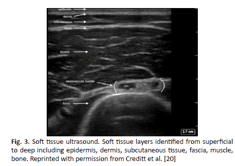 oncologyradiotherapy-soft-tissue