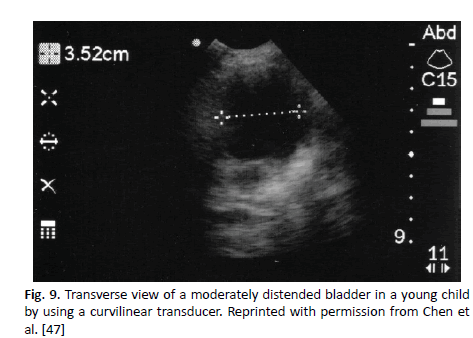 oncologyradiotherapy-transverse oncologyradiotherapy-transverse