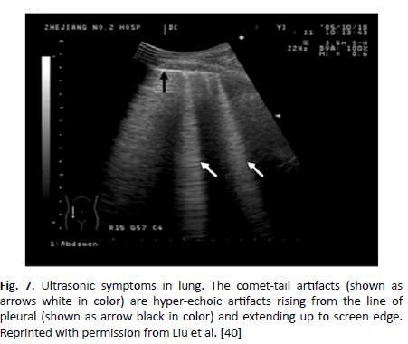 oncologyradiotherapy-ultrasonic